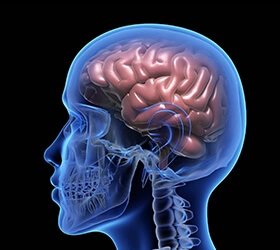 Deep Brain Stimulation