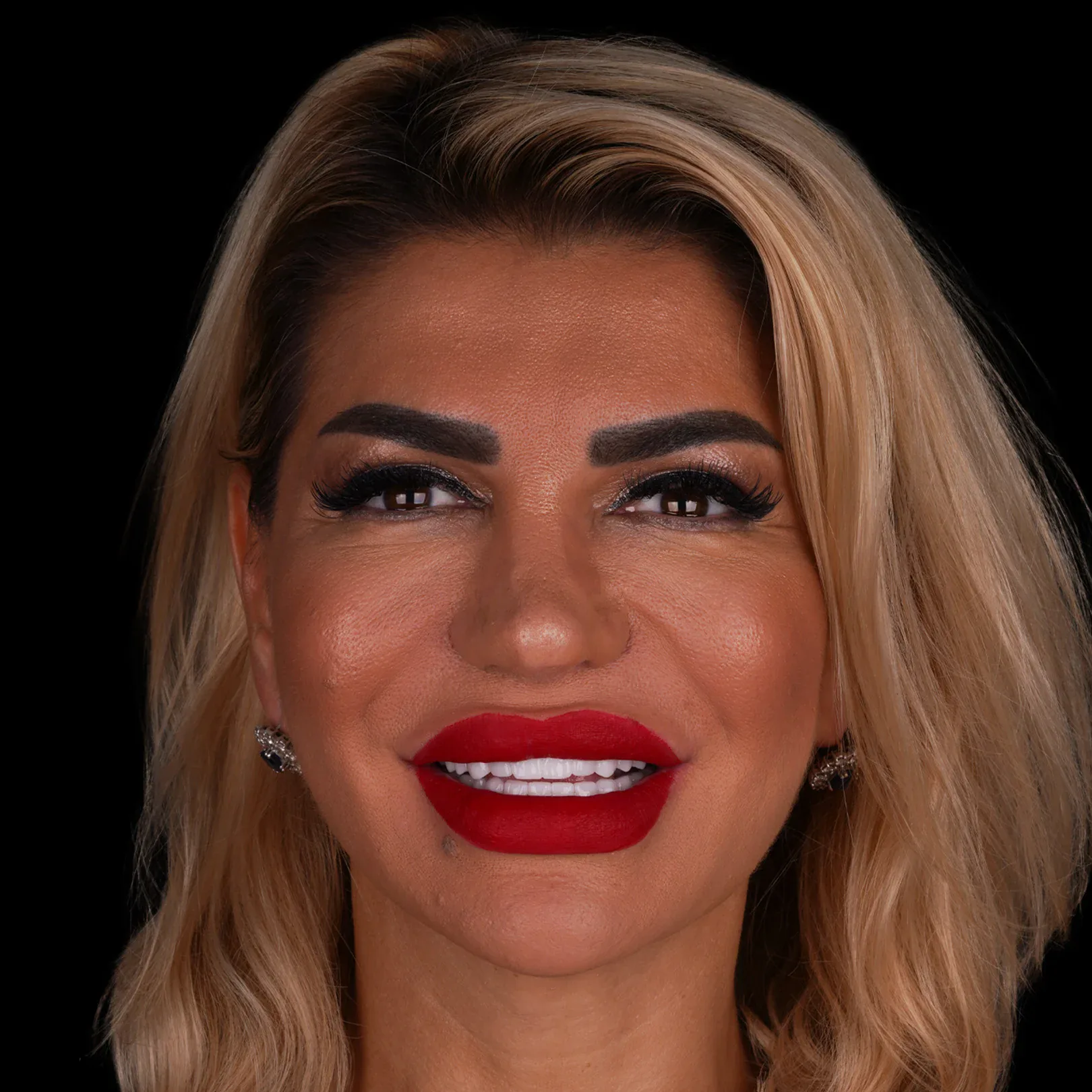 18