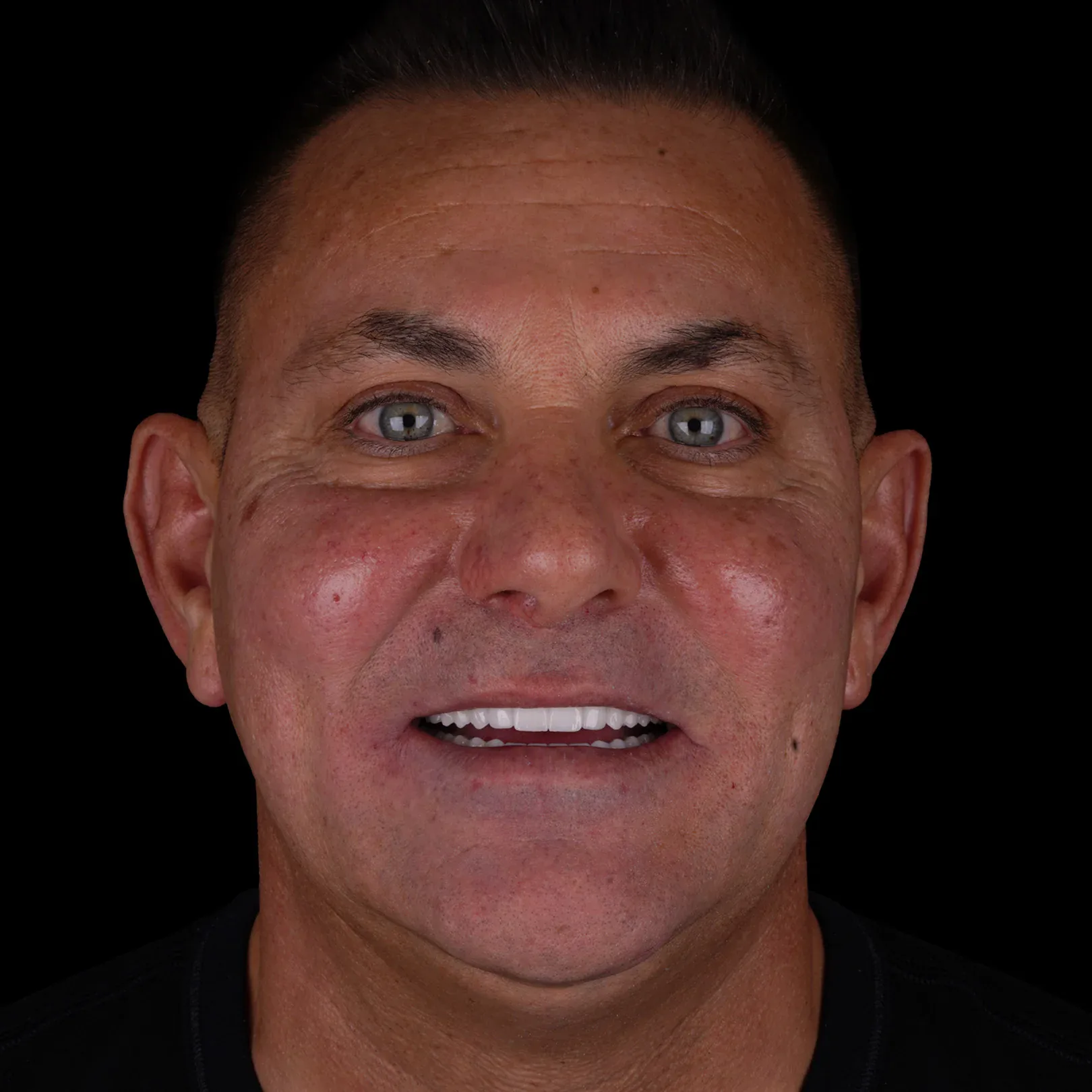 54