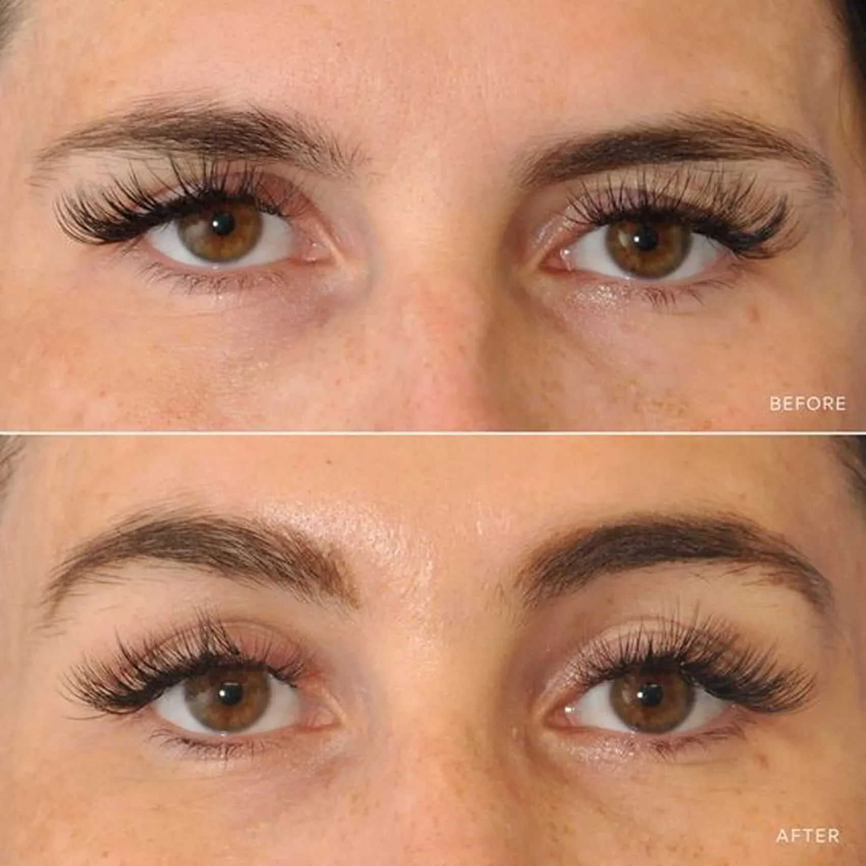 Advantages of Eyebrow Lift