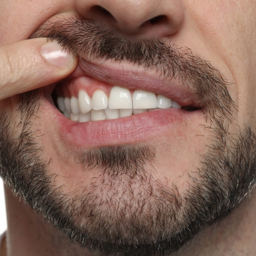 Advantages of Periodontology