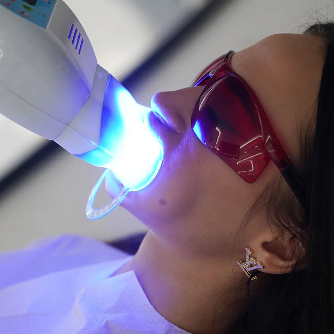 Advantages of Teeth Whitening