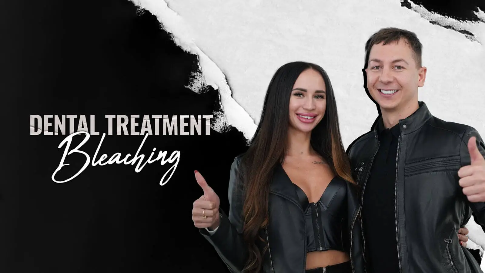 Teeth-Whitening-in-istanbulTurkey