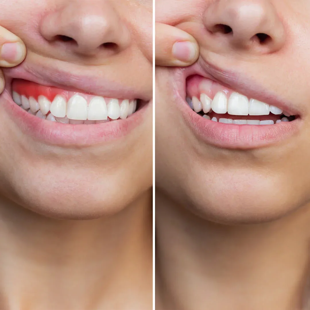 What Are Periodontology