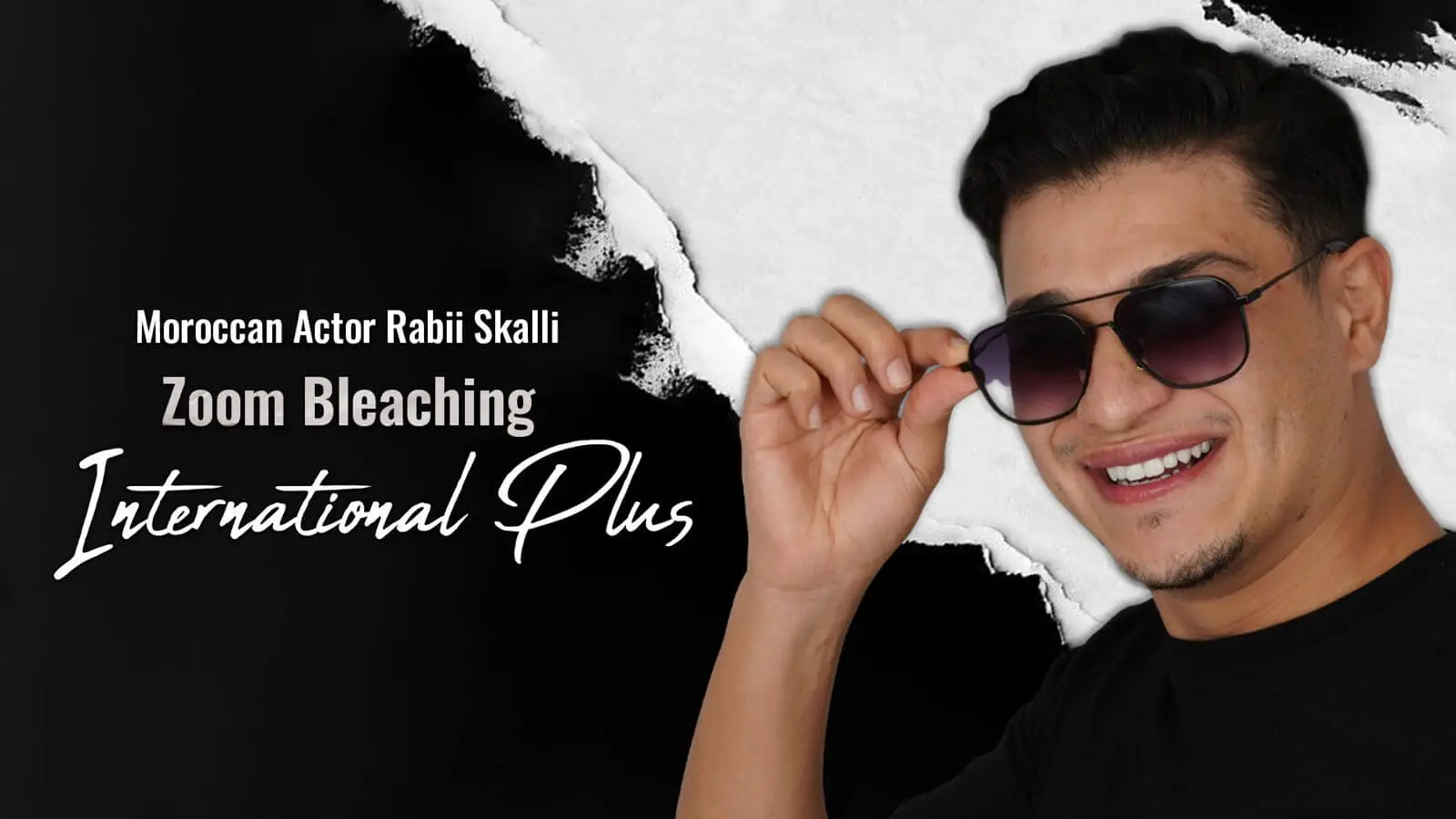 Who-qualifies-for-Teeth-Whitening-1