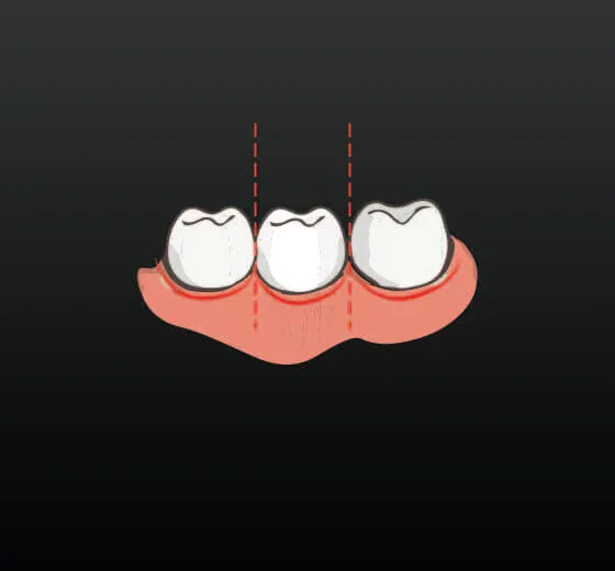 Digital Smile Design