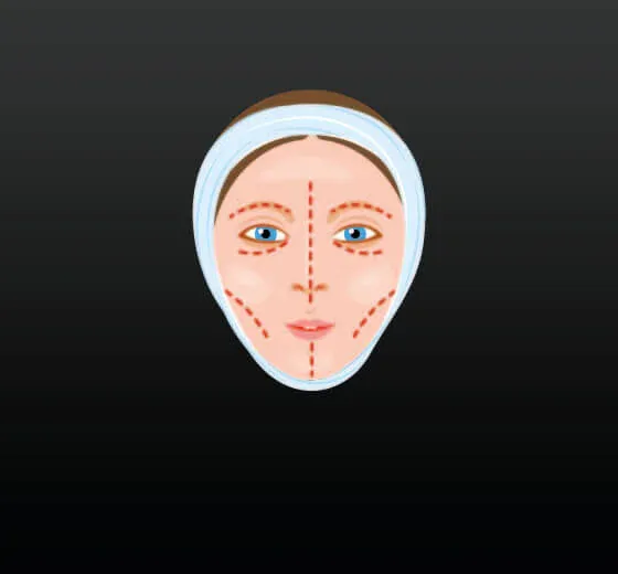 Face Lift