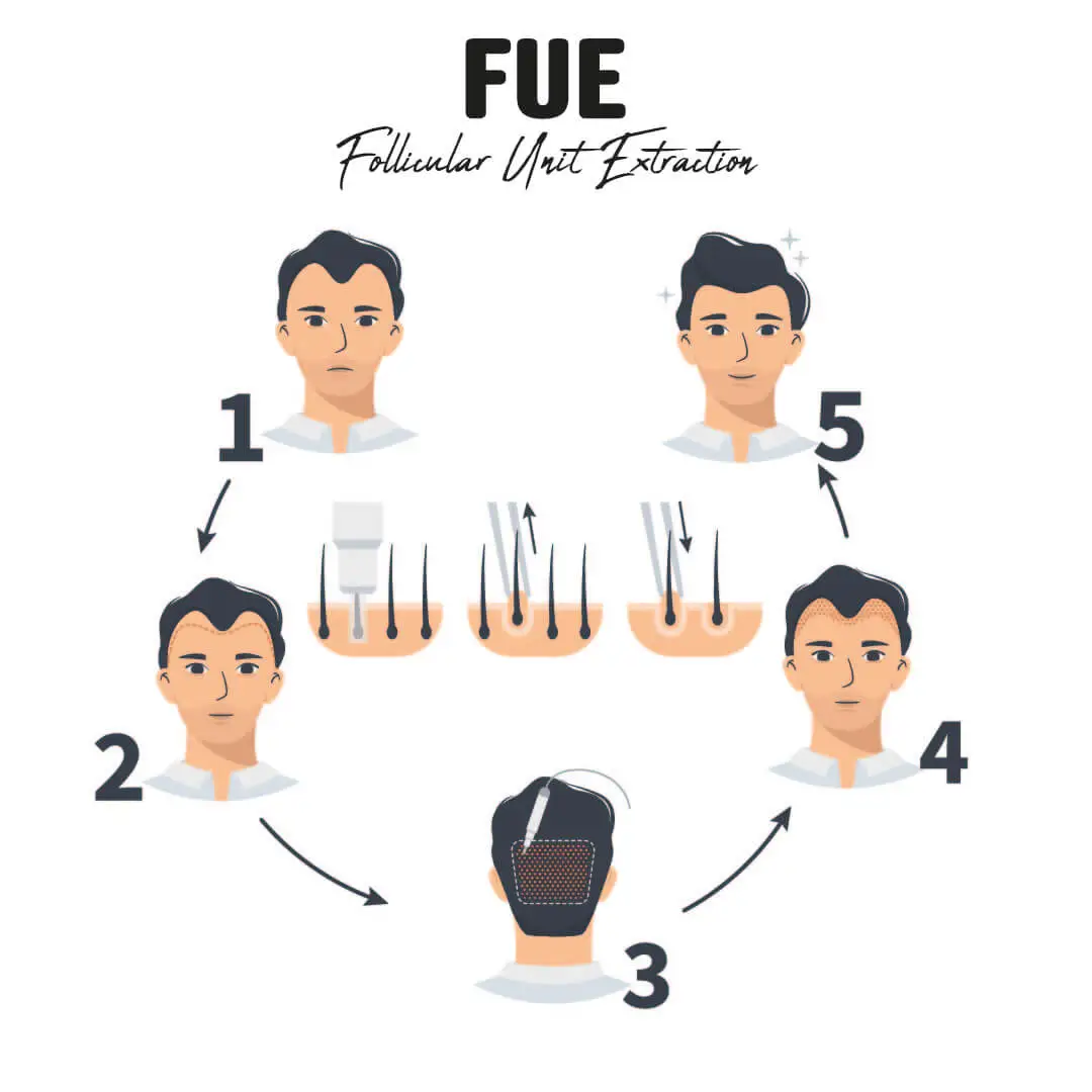 fue technique