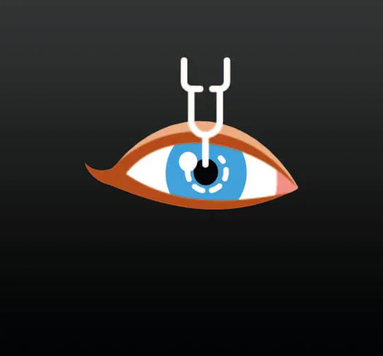 Laser Operation