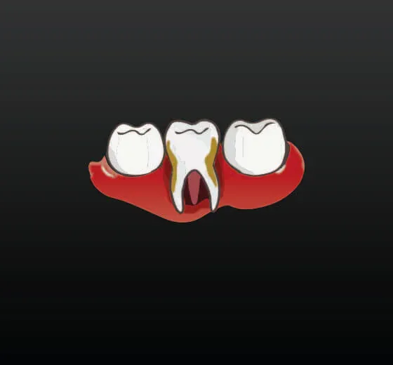 Periodontology