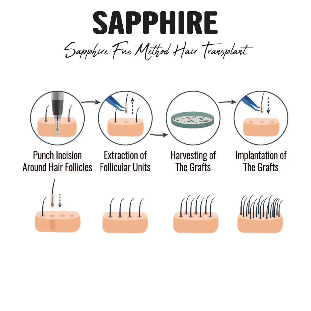 sapphire technique