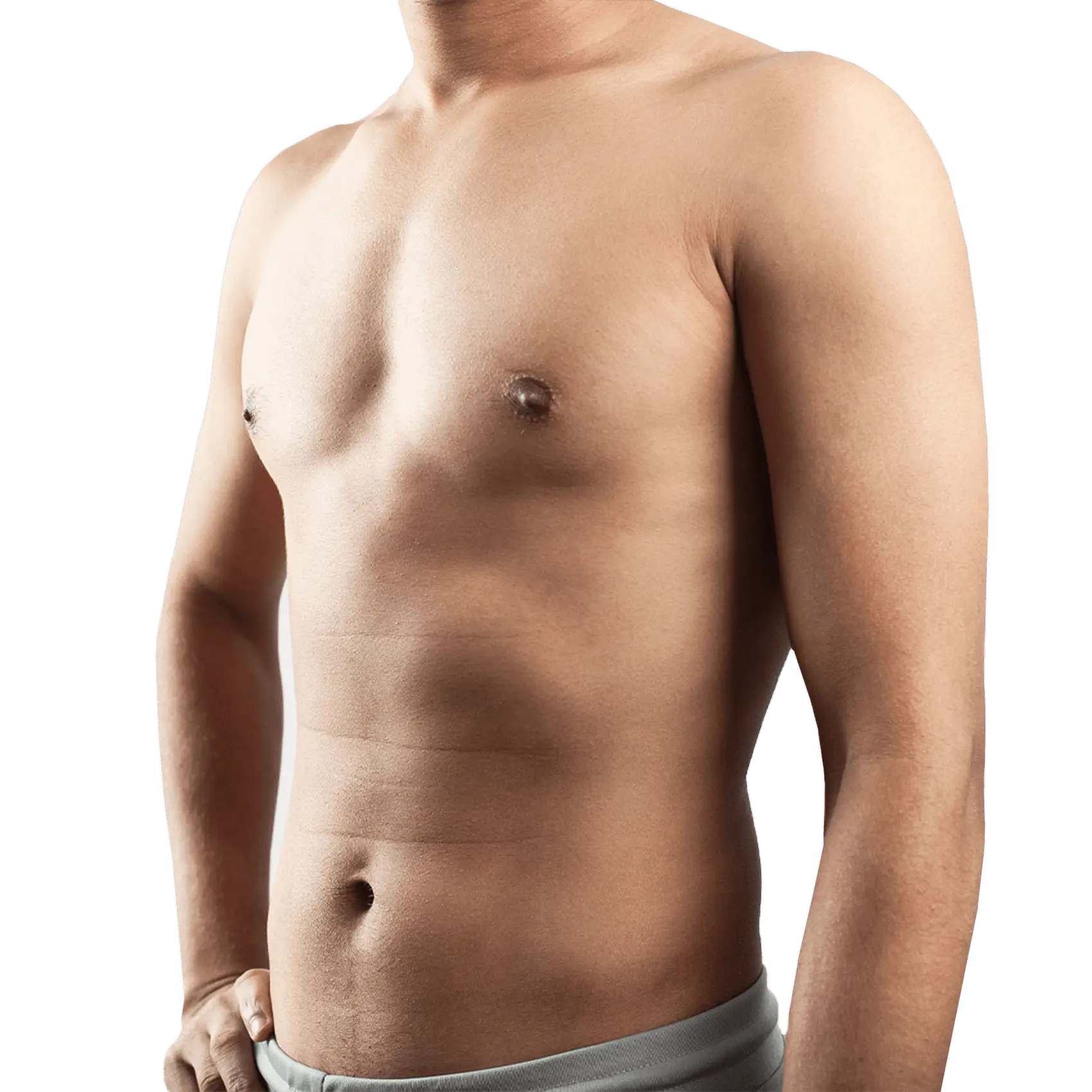 After Gynecomastia Surgery