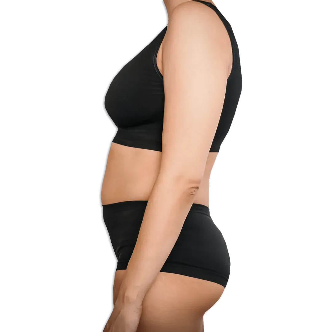 Before Abdominoplasty (Tummy Tuck) Surgery
