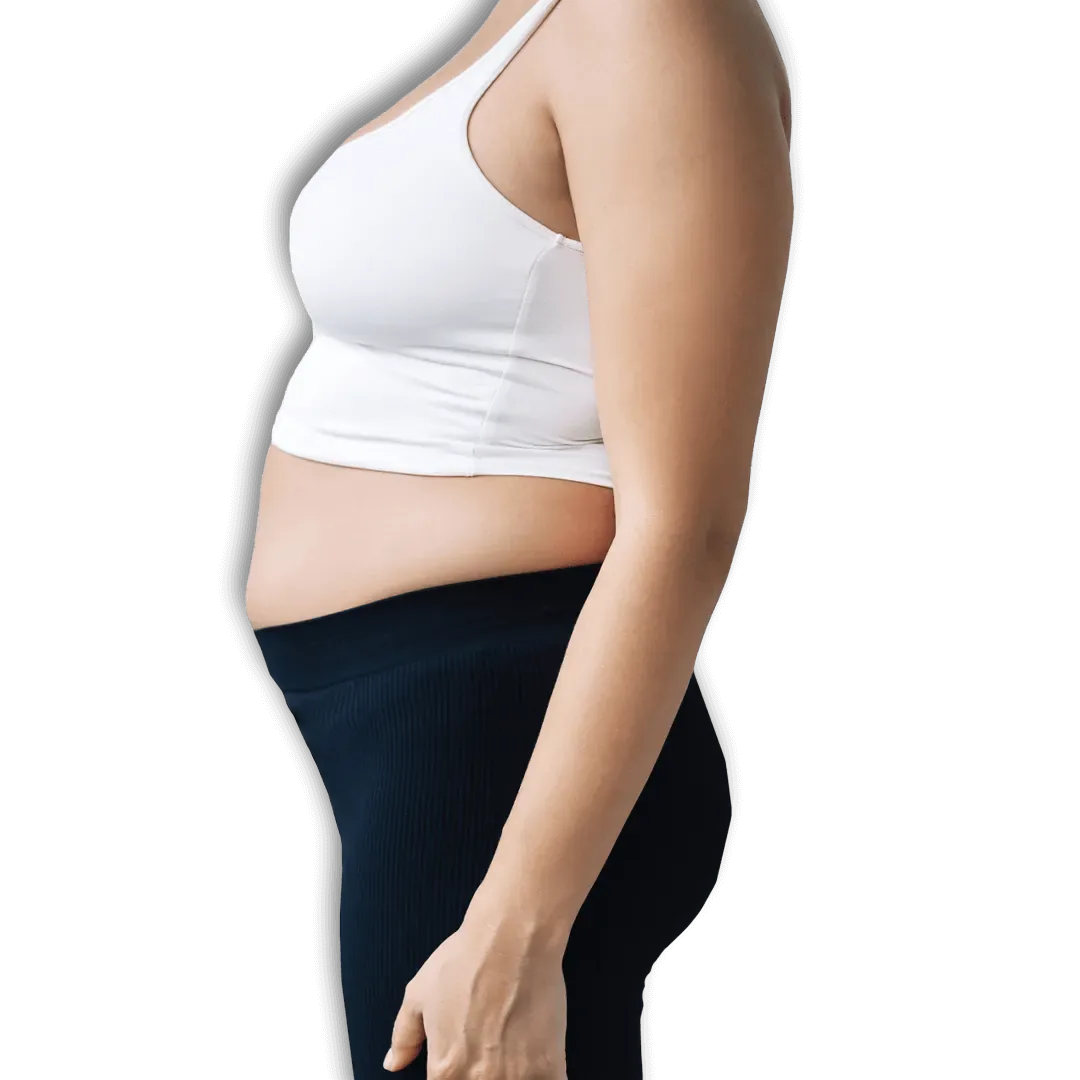 Before Gastric Balloon Surgery