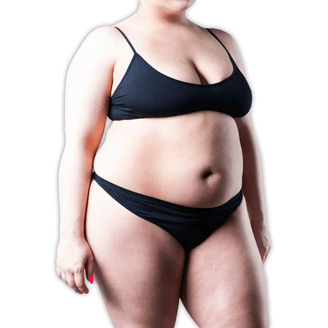 Before Gastric Sleeve Surgery