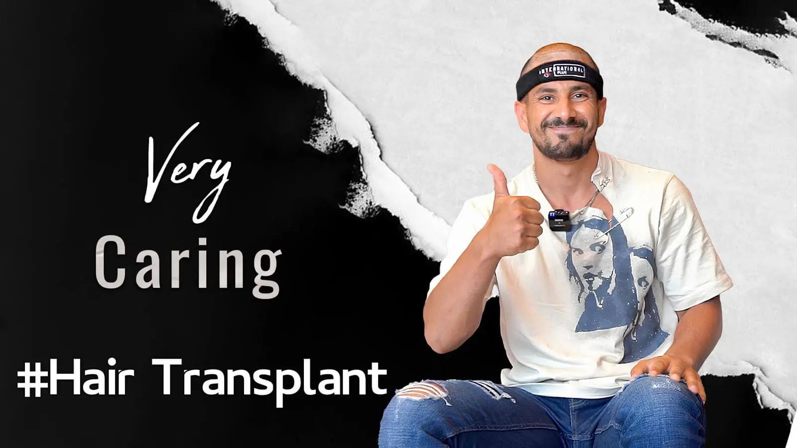 Hair-Transplant-in-istanbulTurkey
