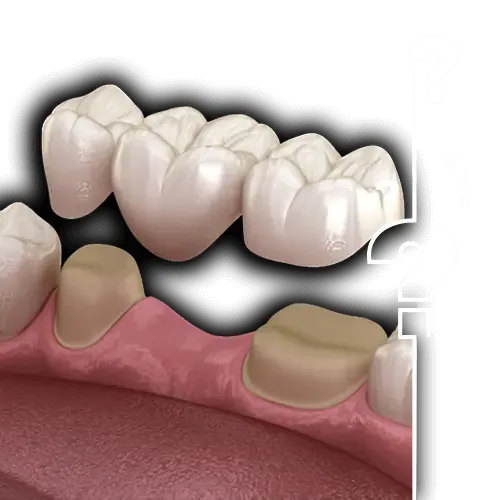 How Much Does Dental Crowns Cost