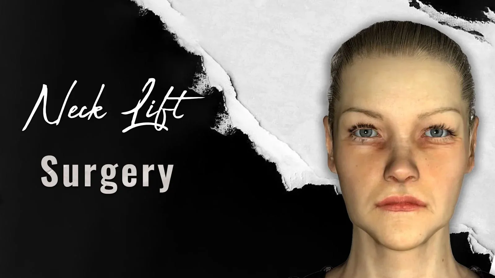 Neck-Liposuction-in-istanbulTurkey