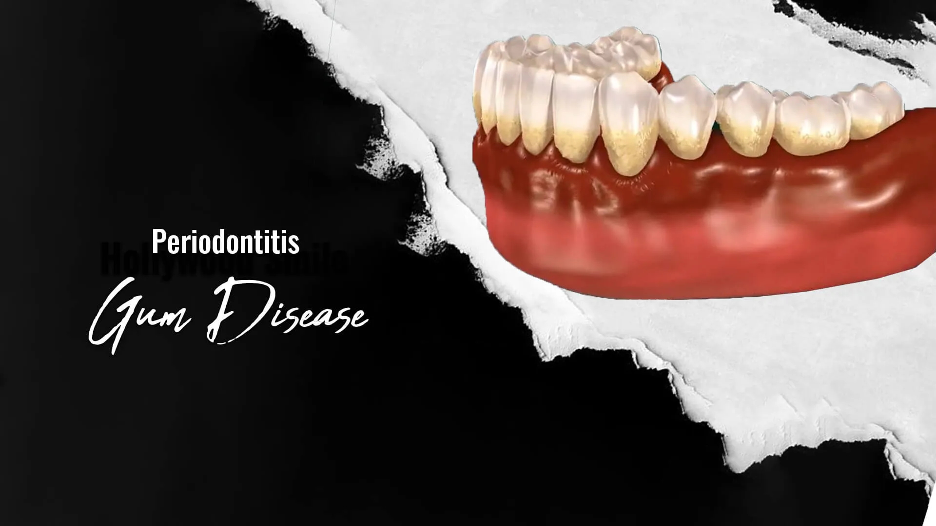 Periodontology-in-IstanbulTurkey