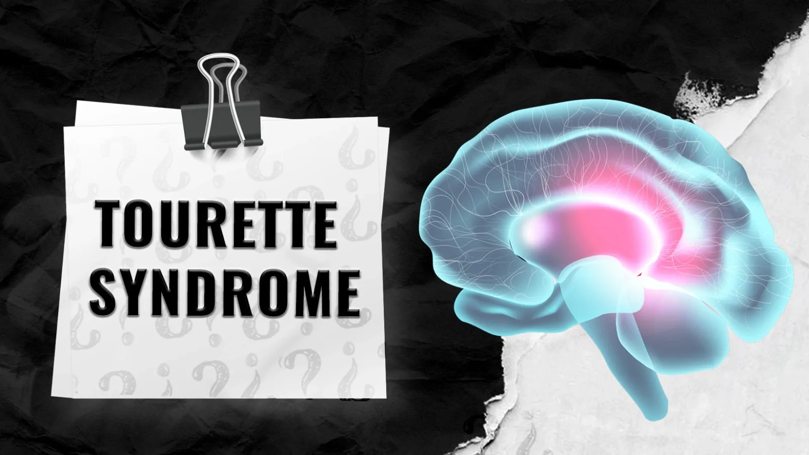 Tourette-Syndrome