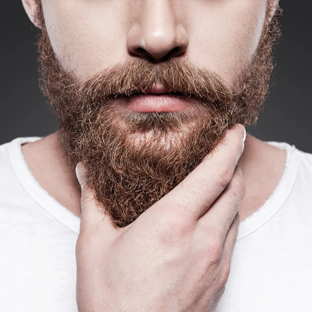 What is Beard Transplant
