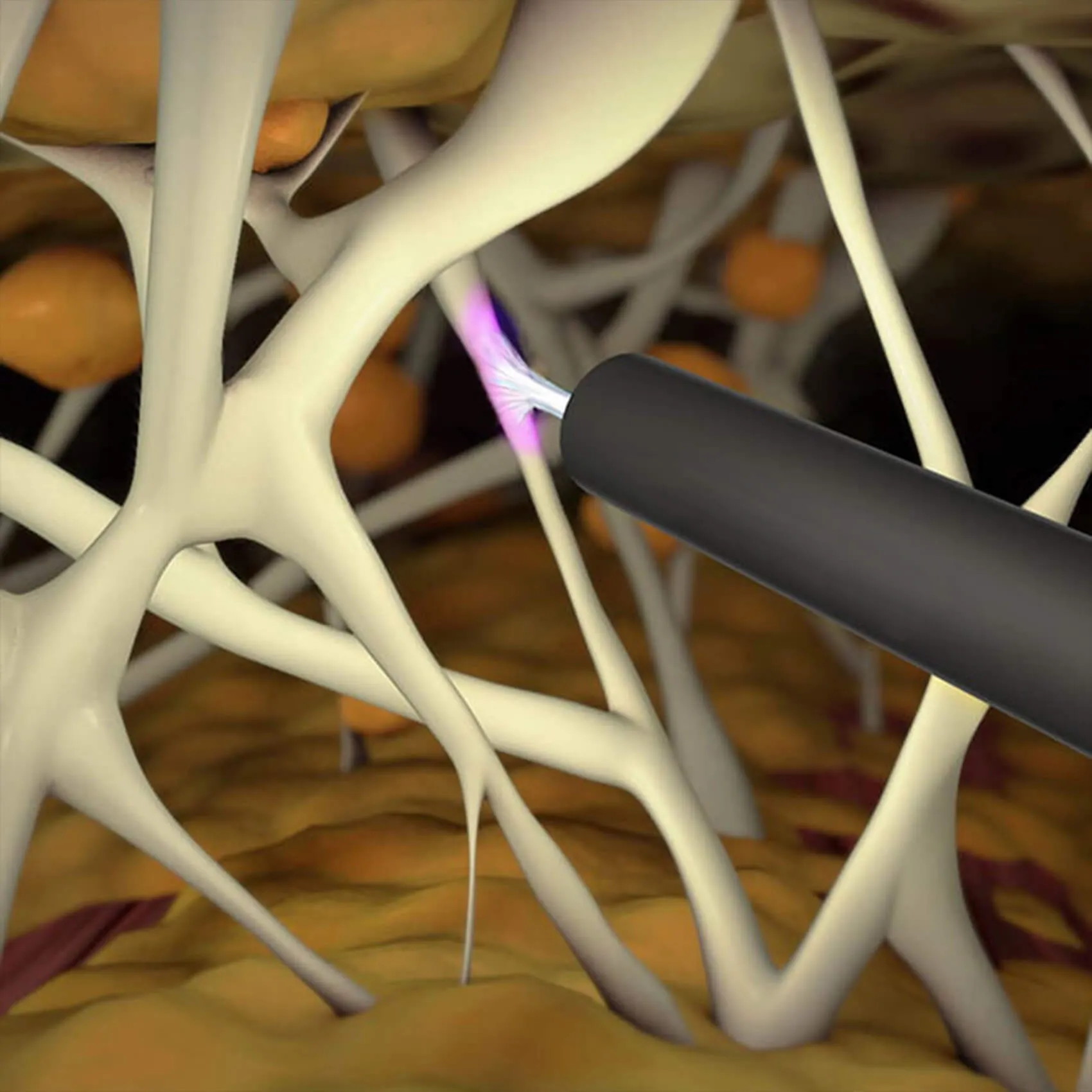 What is J plasma