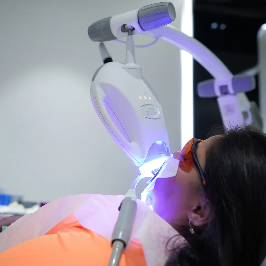 What is Teeth Whitening