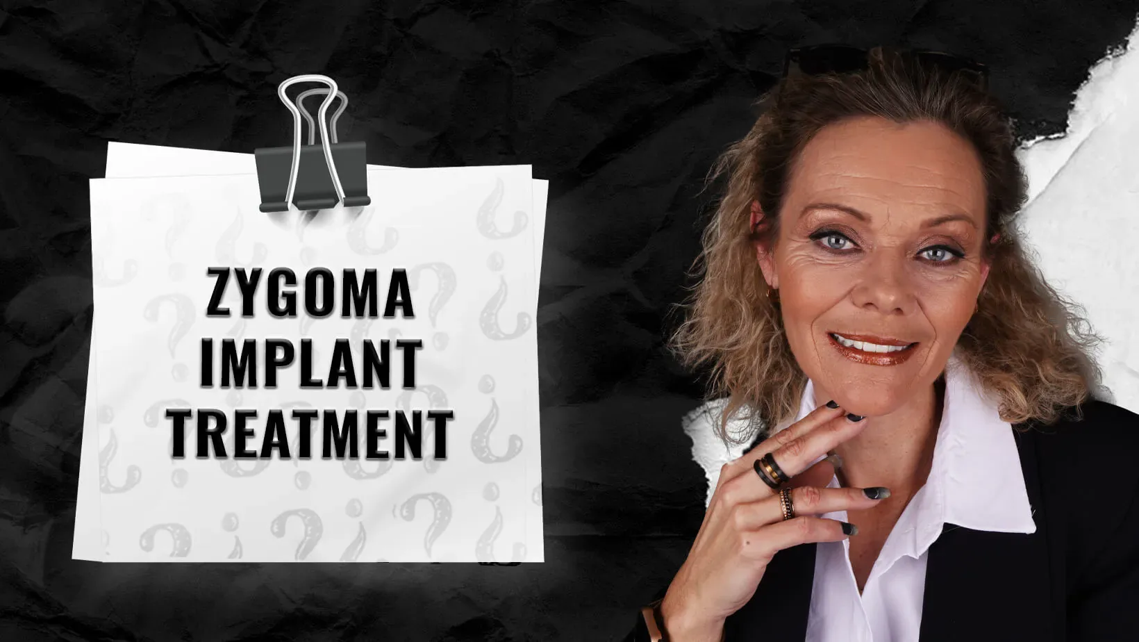 What-is-the-Zygomatic-Implant