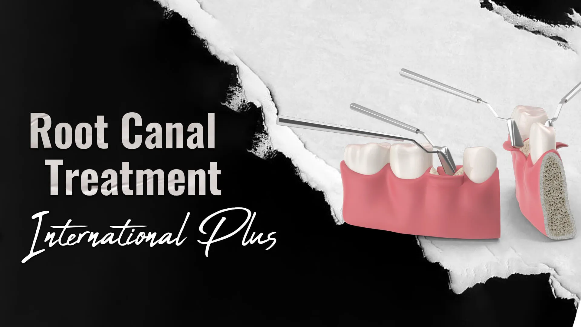 Who-qualifies-for-Endodontics