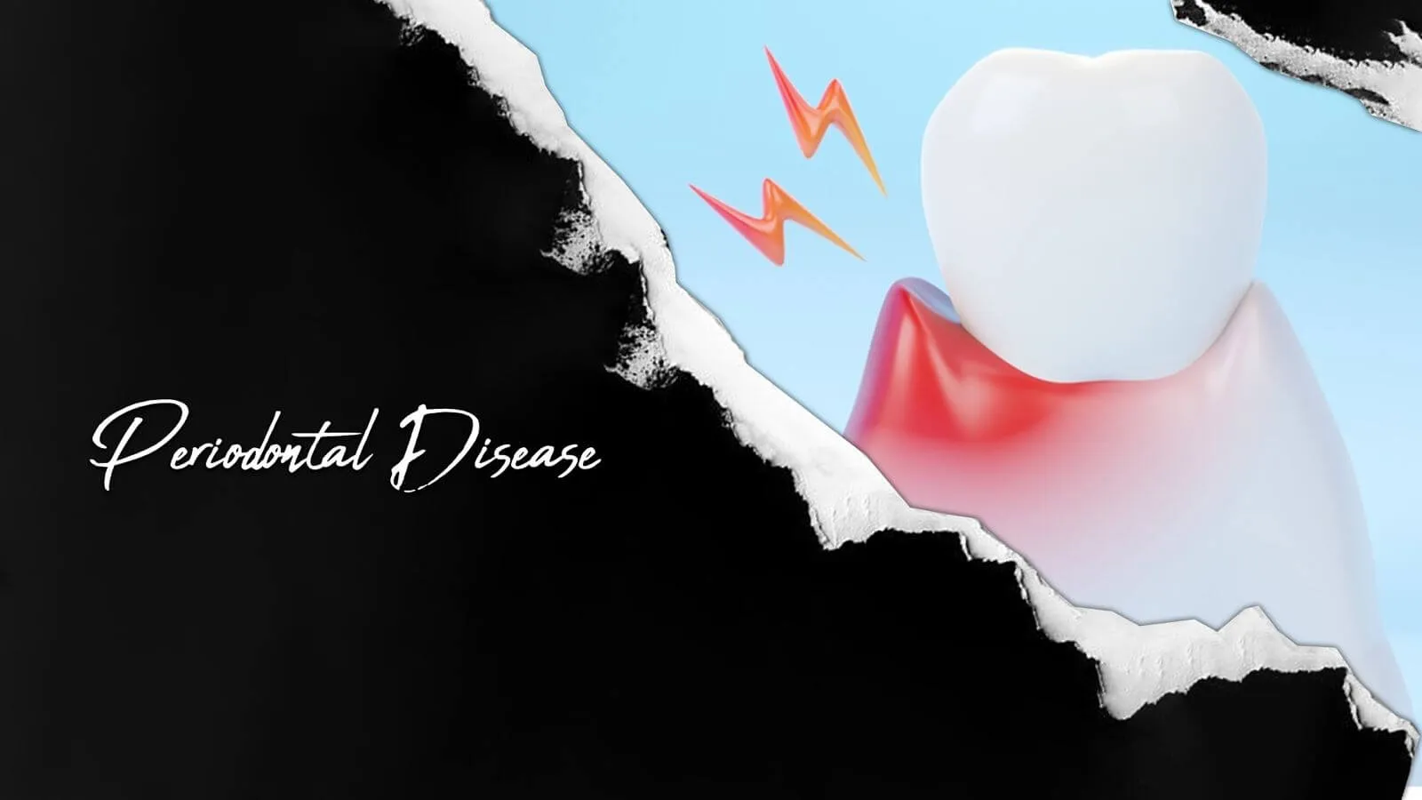 Who-qualifies-for-Periodontology