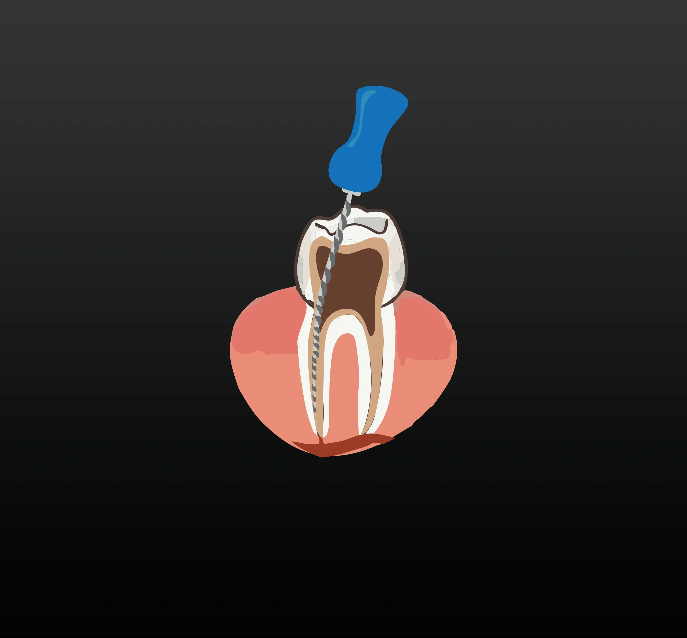 Endodontics