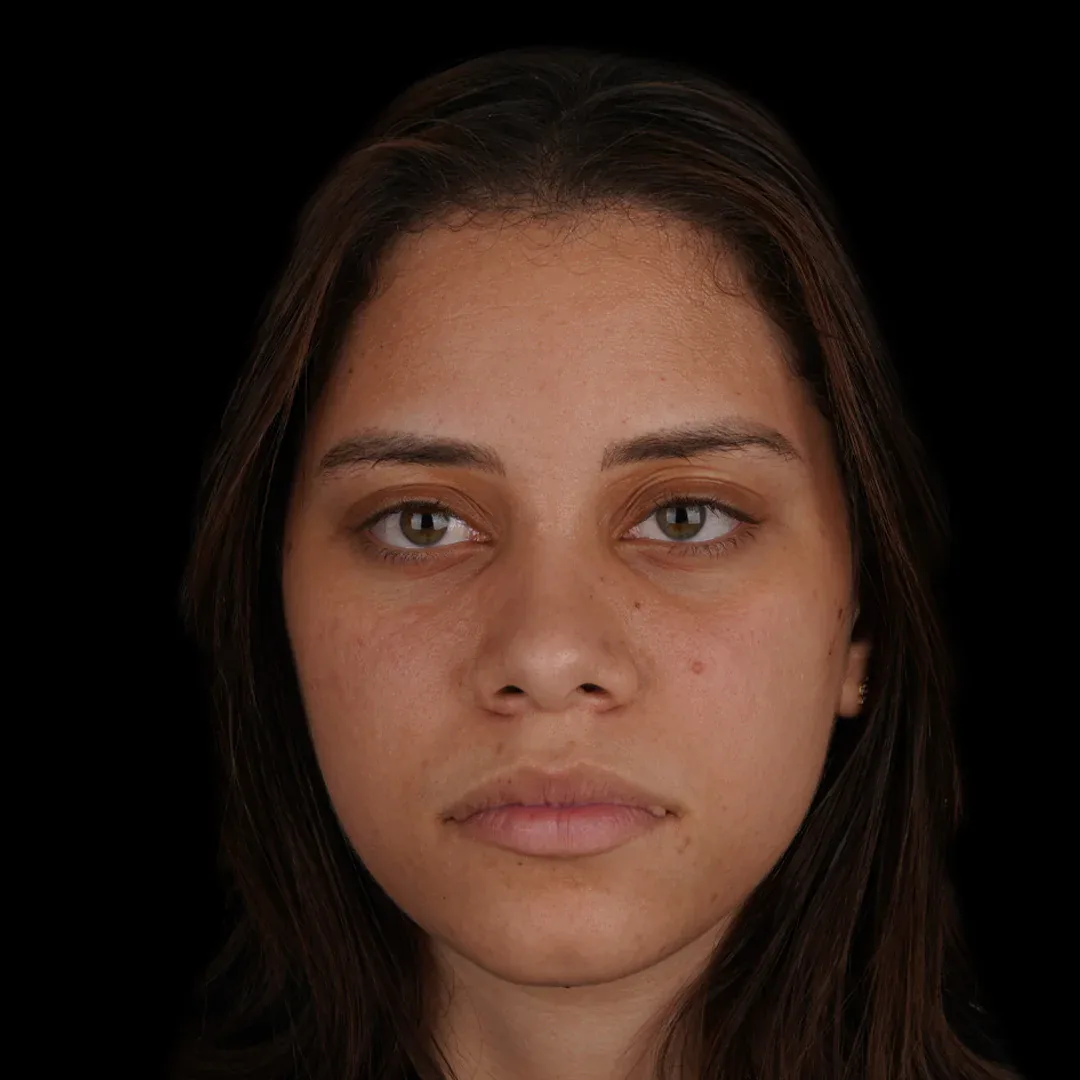 Medical Aesthetic before after 15