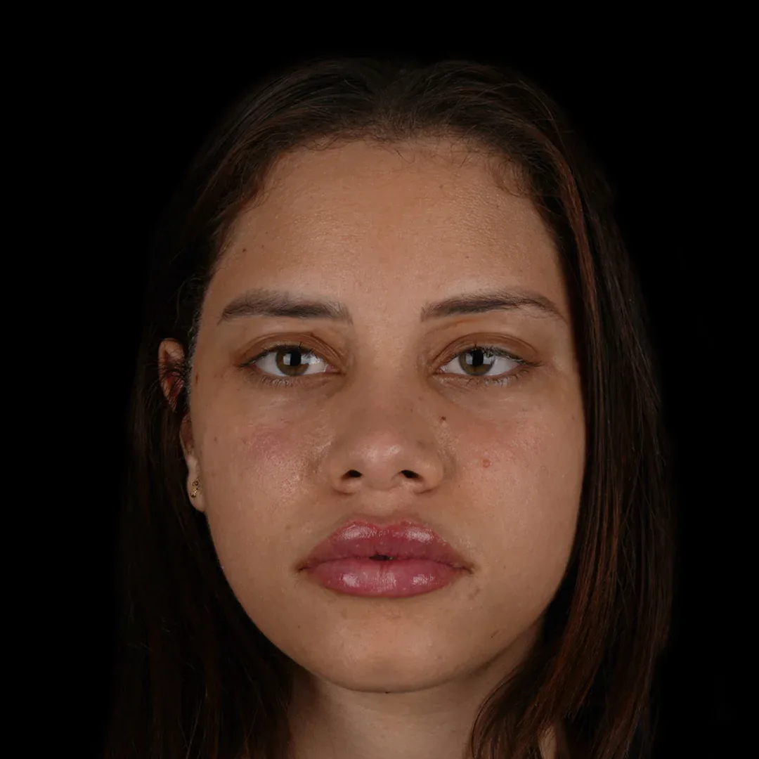 Medical Aesthetic before after 16