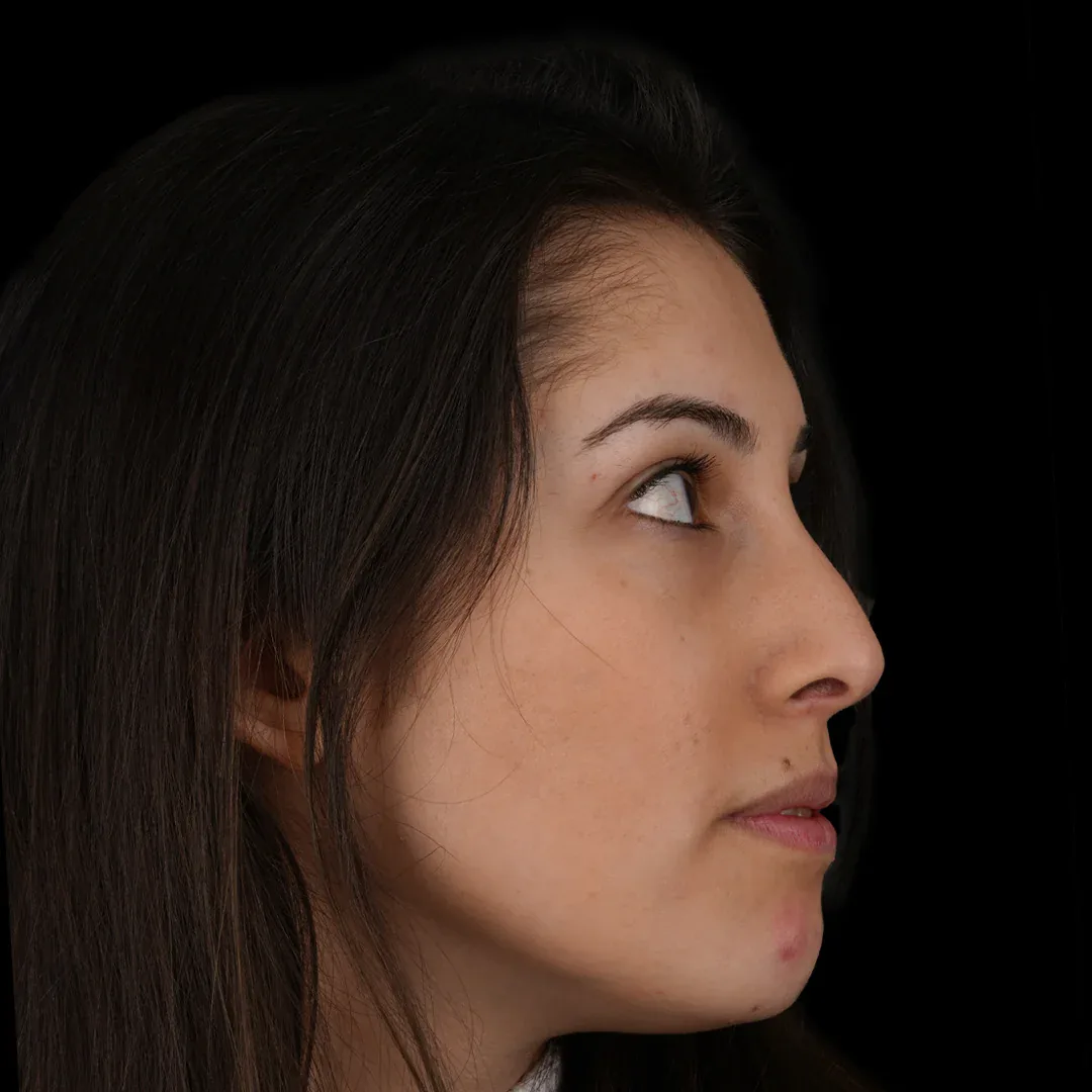 Medical Aesthetic before after 17