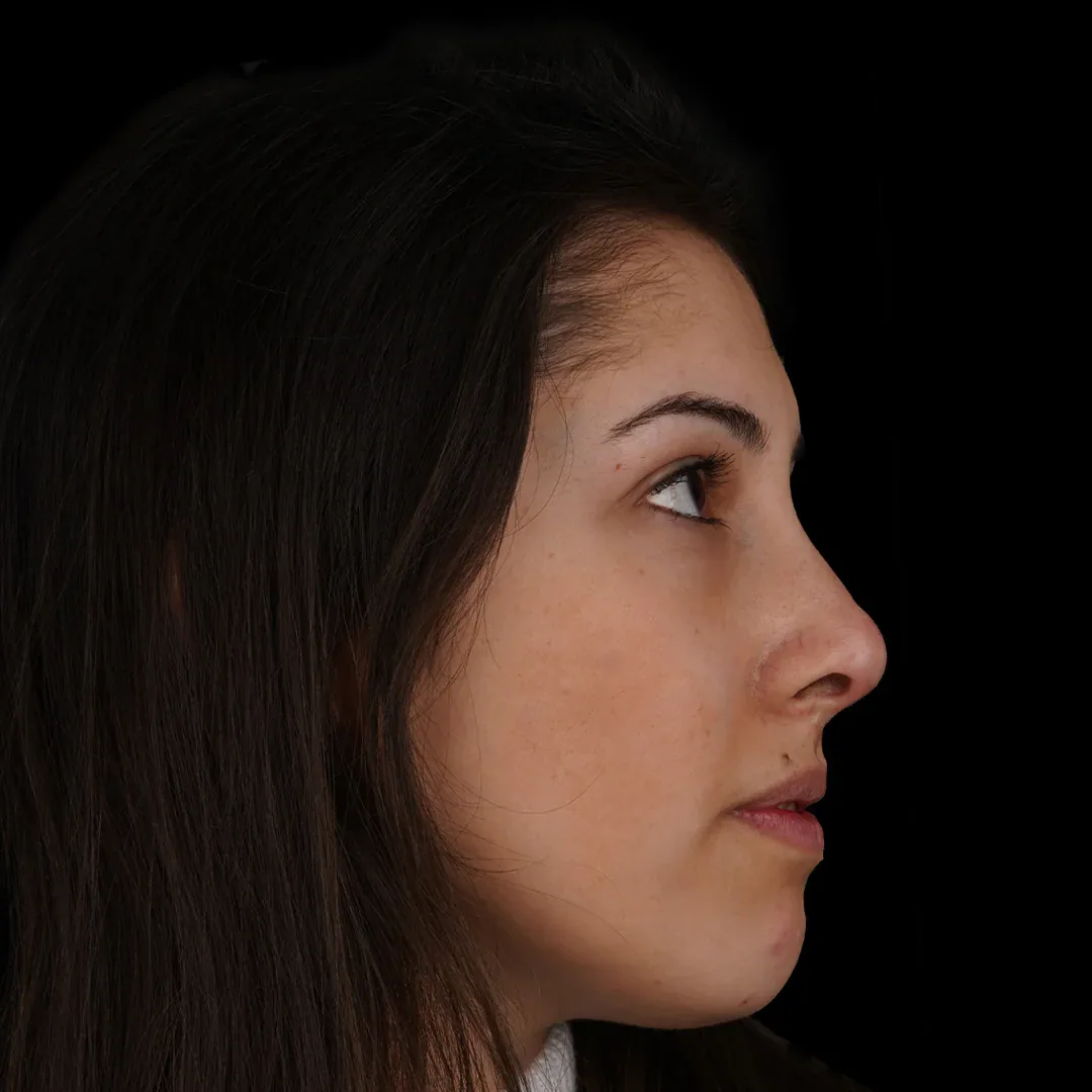 Medical Aesthetic before after 18