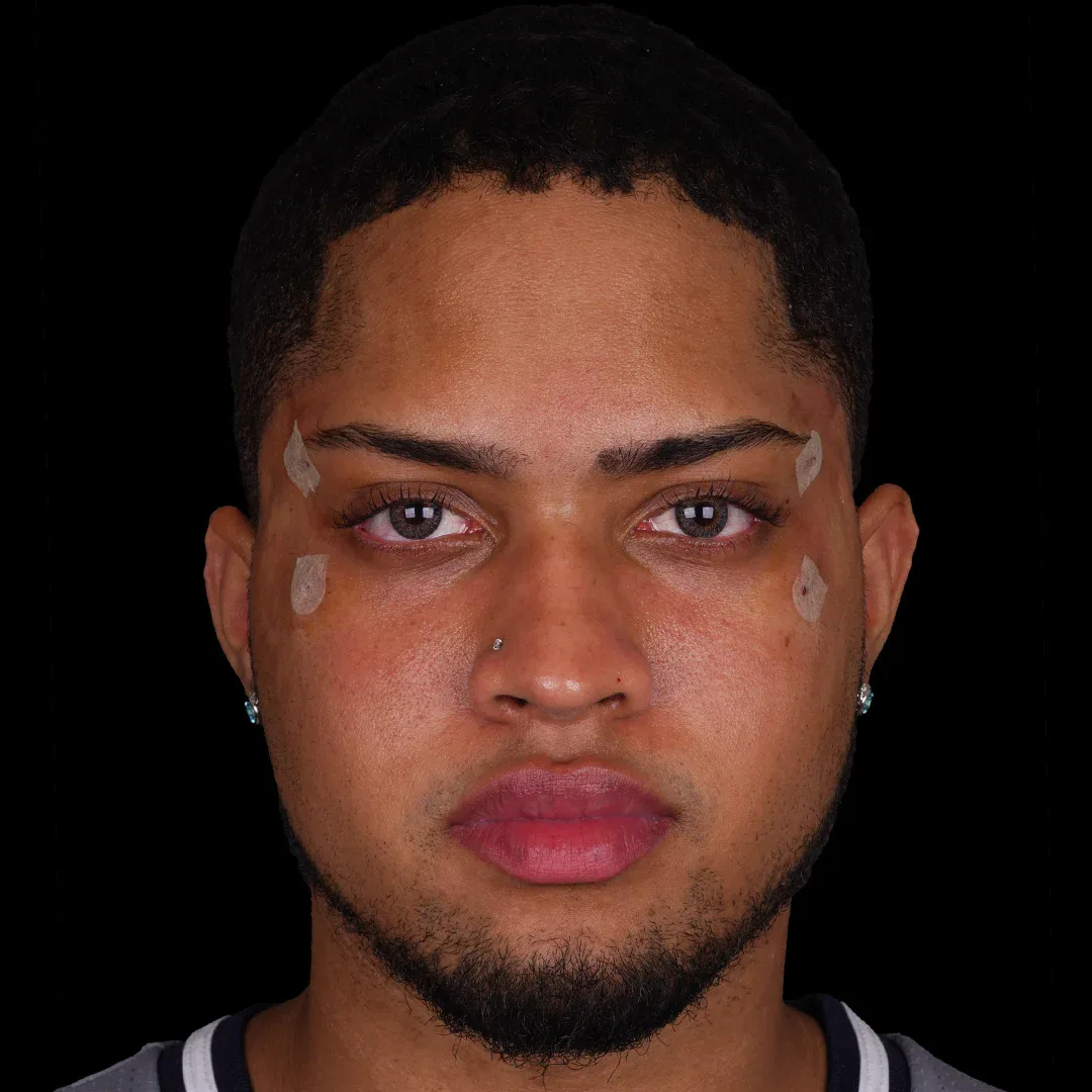 Medical Aesthetic before after 20