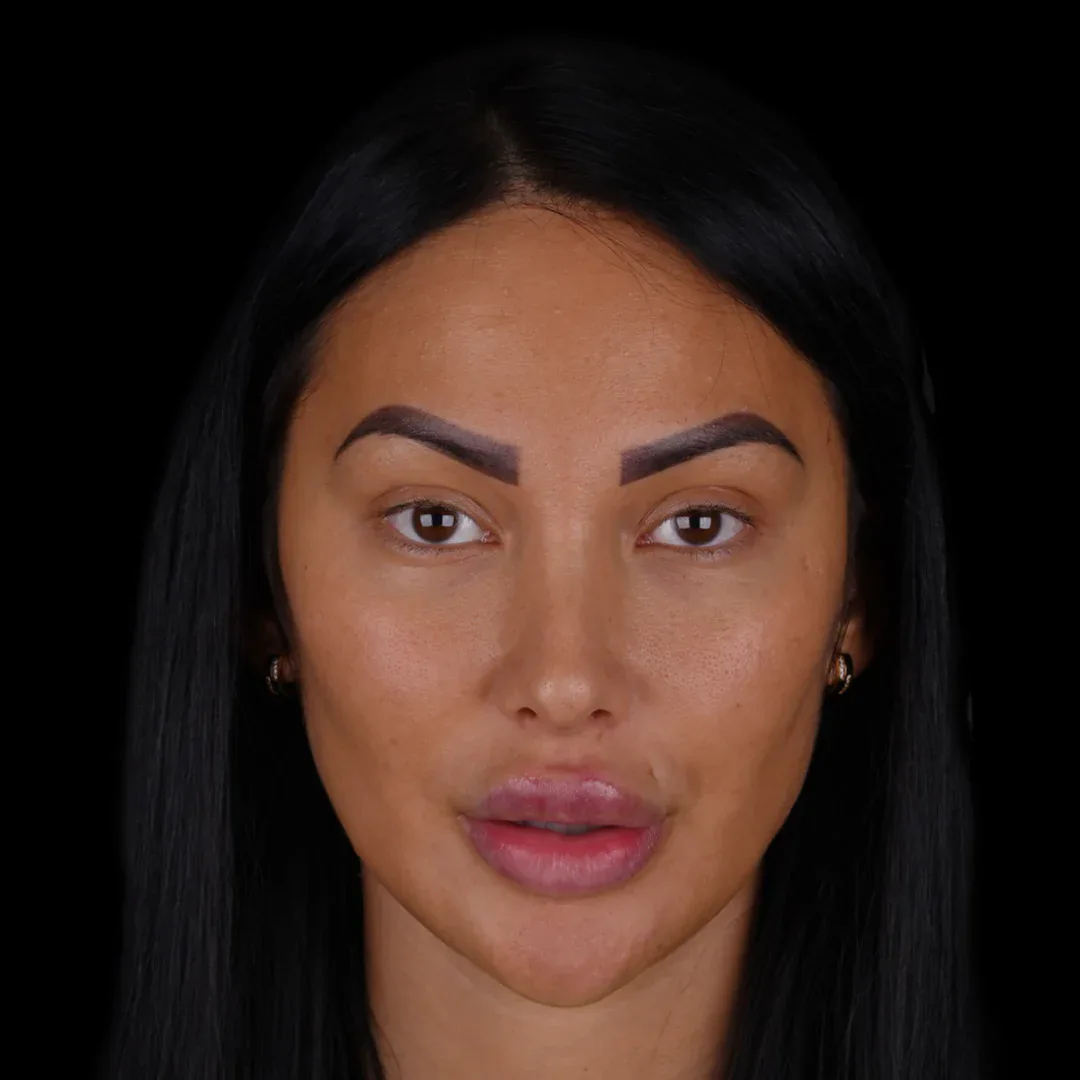 Medical Aesthetic before after 21