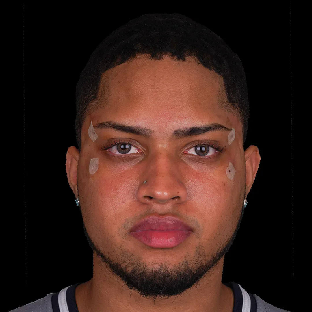 Medical Aesthetic before after 7