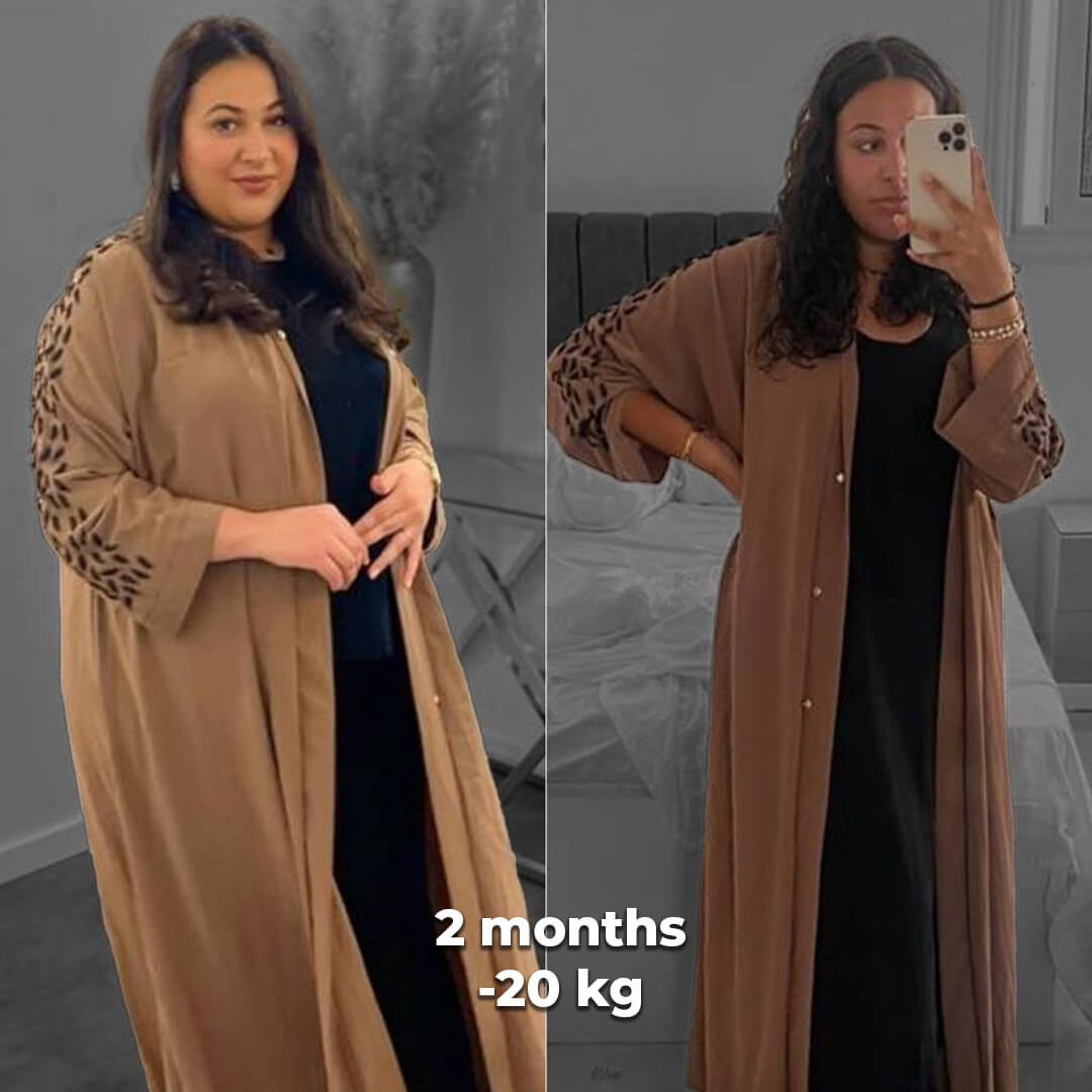 bariatric gallery 1