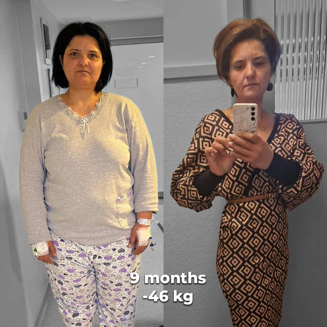 bariatric gallery 10
