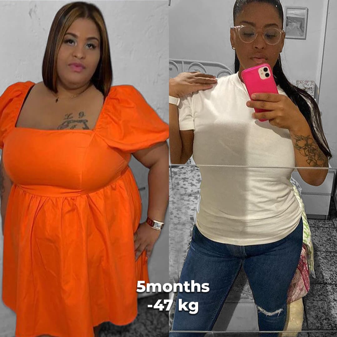 bariatric gallery 11
