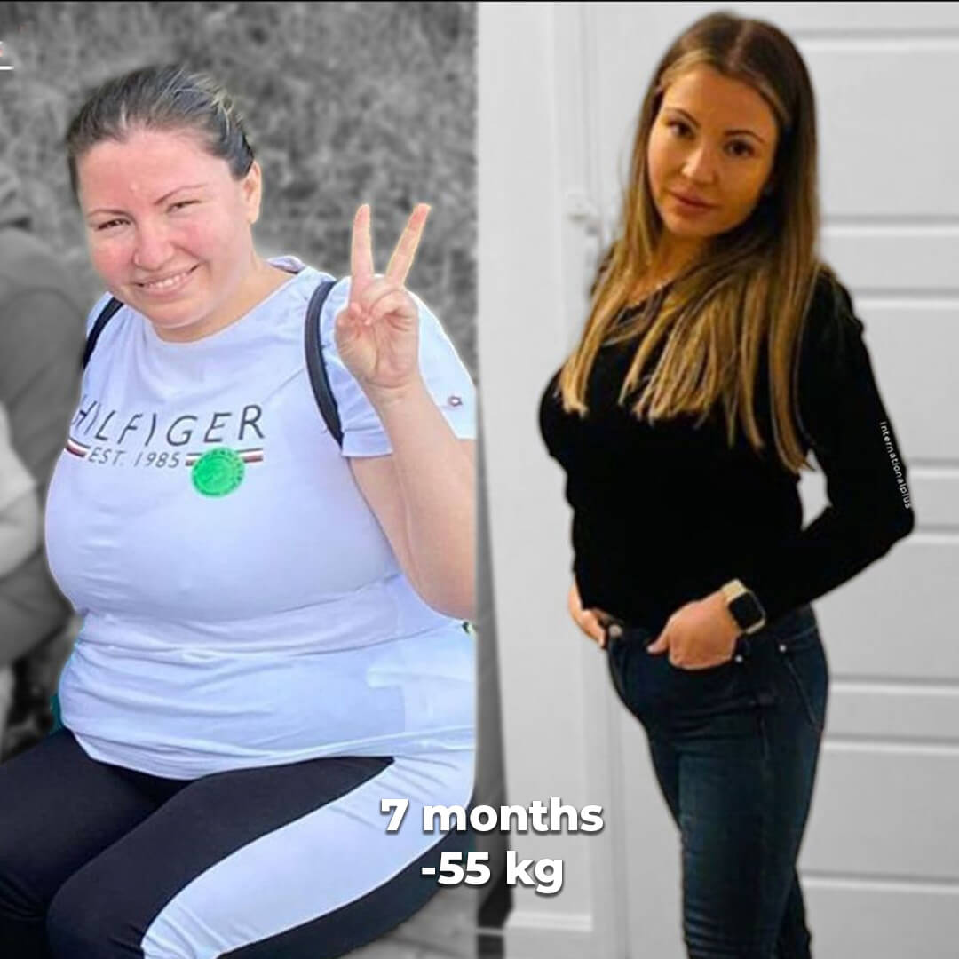 bariatric gallery 12
