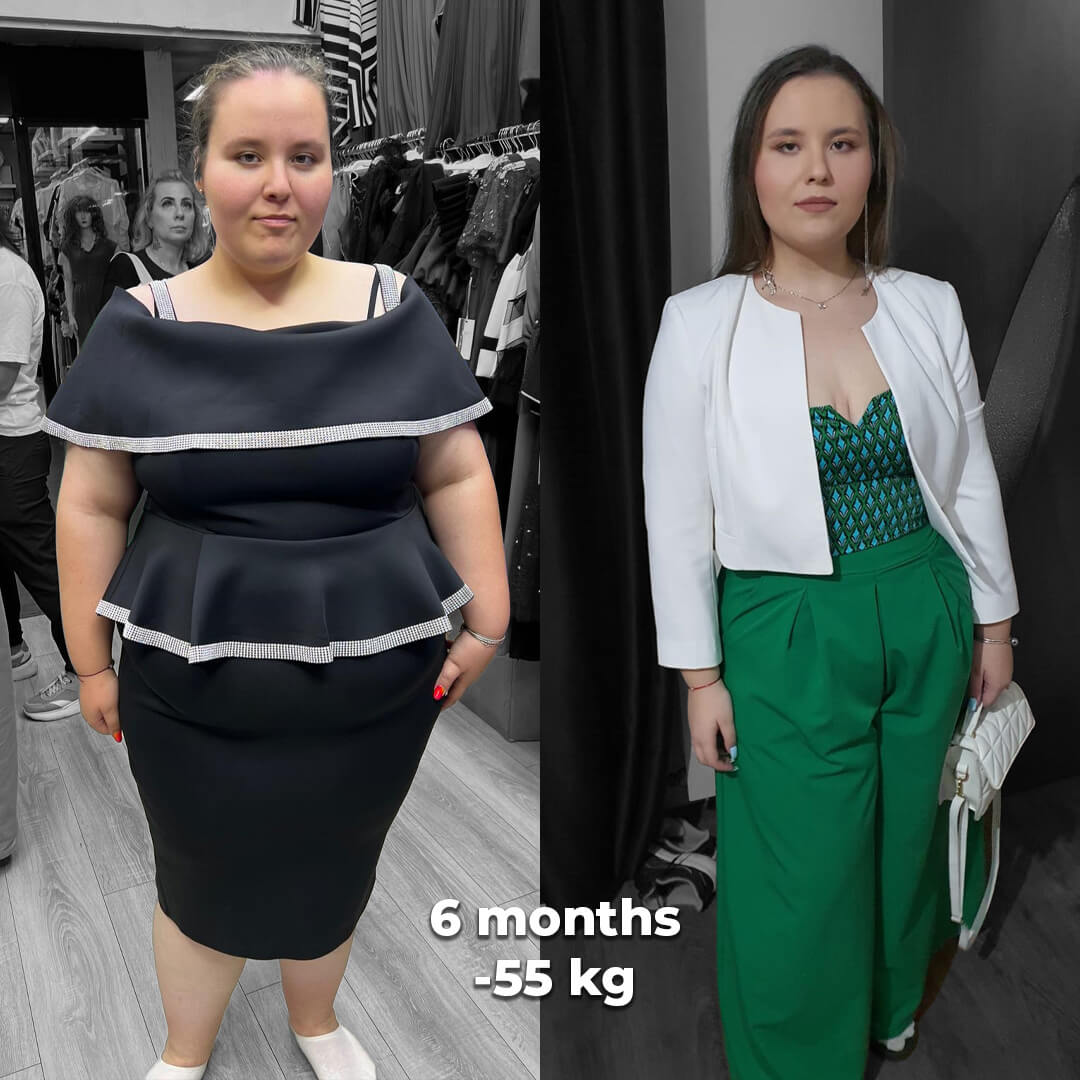 bariatric gallery 2