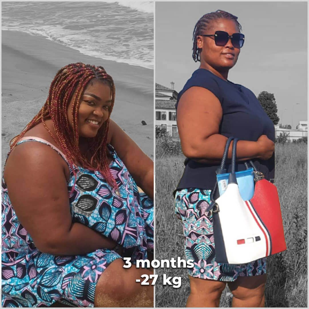 bariatric gallery 3