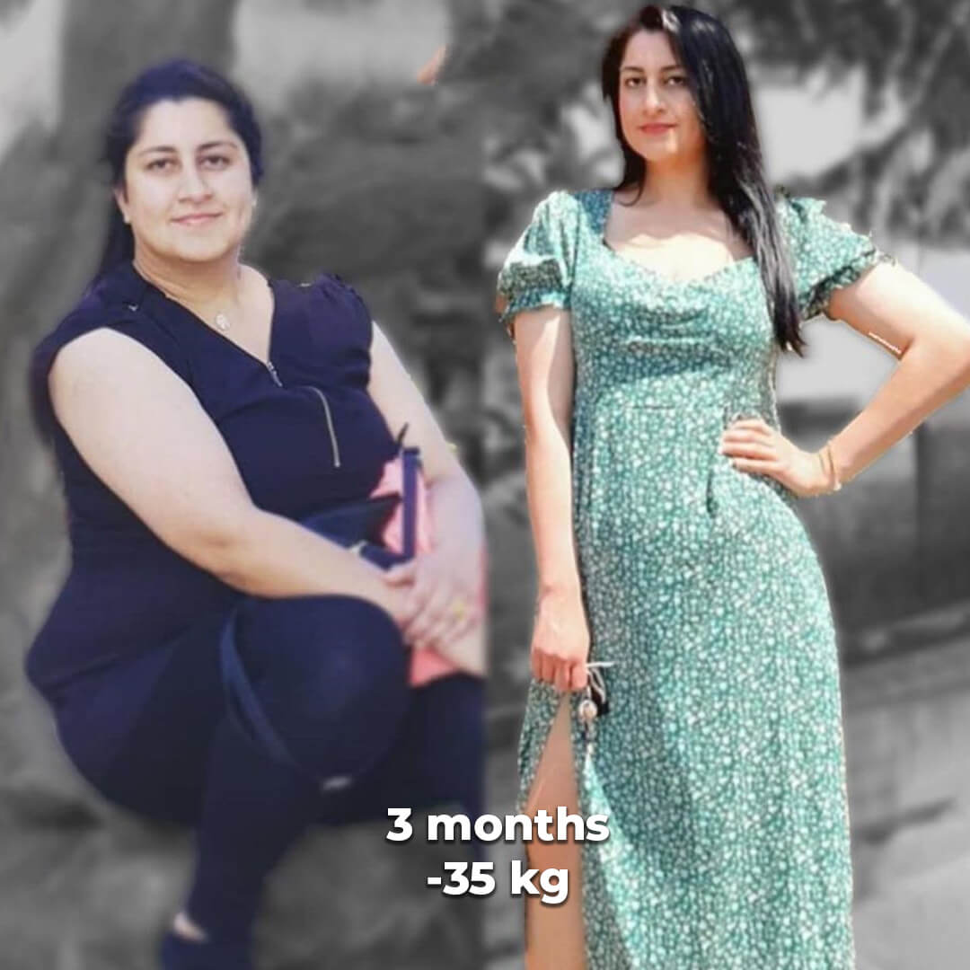 bariatric gallery 4