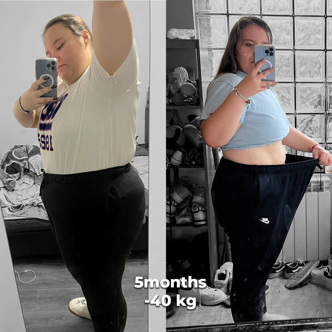 bariatric gallery 5