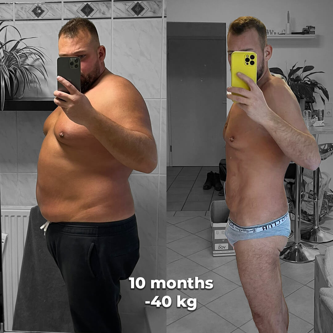 bariatric gallery 6