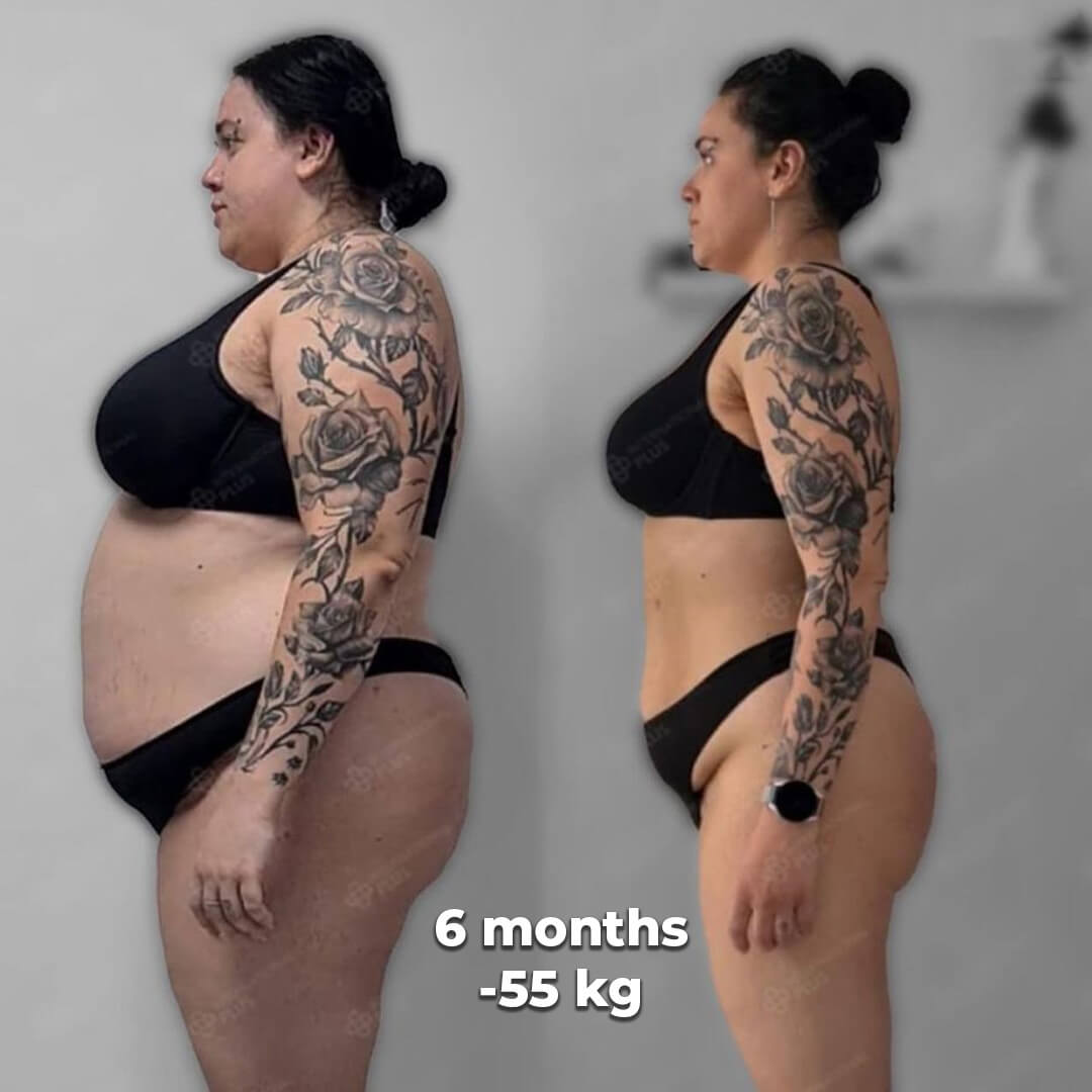 bariatric gallery 8