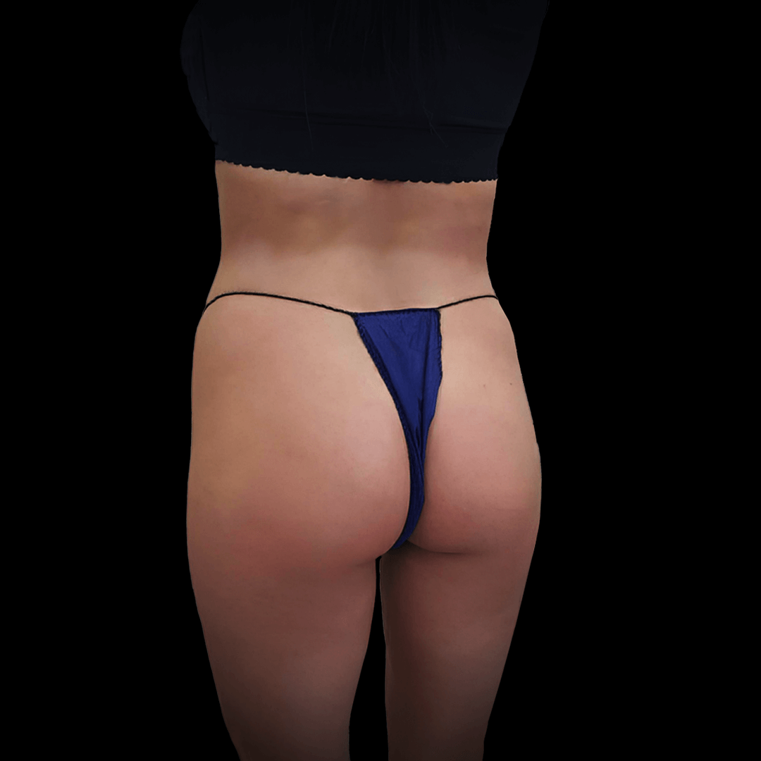 bbl gallery 1