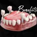 Benefits of Dental Implants